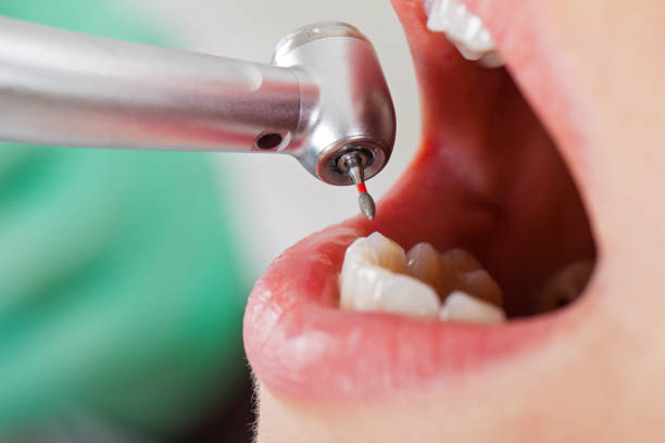 Best Broken or Chipped Tooth Repair in Homosassa, FL